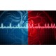 ECG Mystery Solved