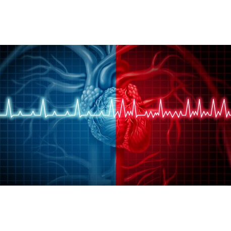 ECG Mystery Solved
