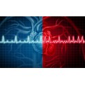 ECG Mystery Solved