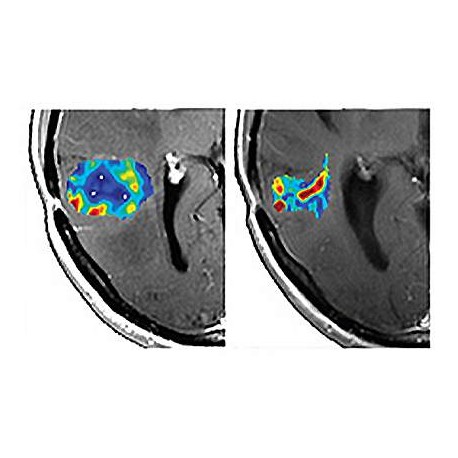 The 3rd international conference Advance in Tumor Imaging