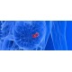Image Guided Breast Interventional workshop