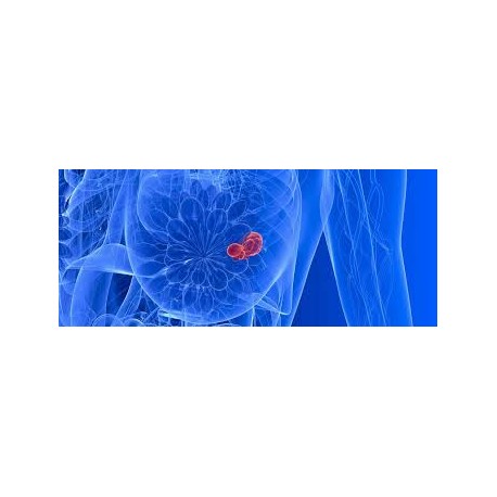 Image Guided Breast Interventional workshop
