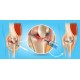 Joint Injections &amp; Minor Office Surgical procedures