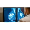 Breast Imaging workshop